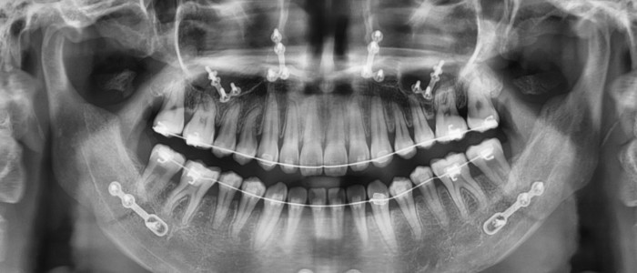 Dental Imaging – Cameras | X-rays | Scanners